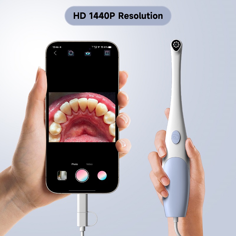กล้องเอนโดสโคปสำหรับตรวจช่องปา - Photography Lighting Handheld บทวิจารณ์และราคา